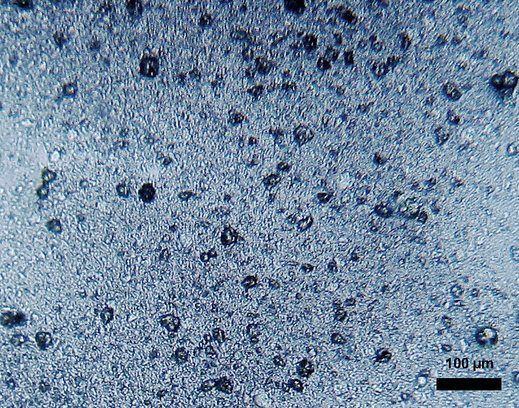 Microscopische opname van microplastics in tandpasta. Nanoplastics zijn 1000 maal kleiner dan microplastics (foto: Dantor)