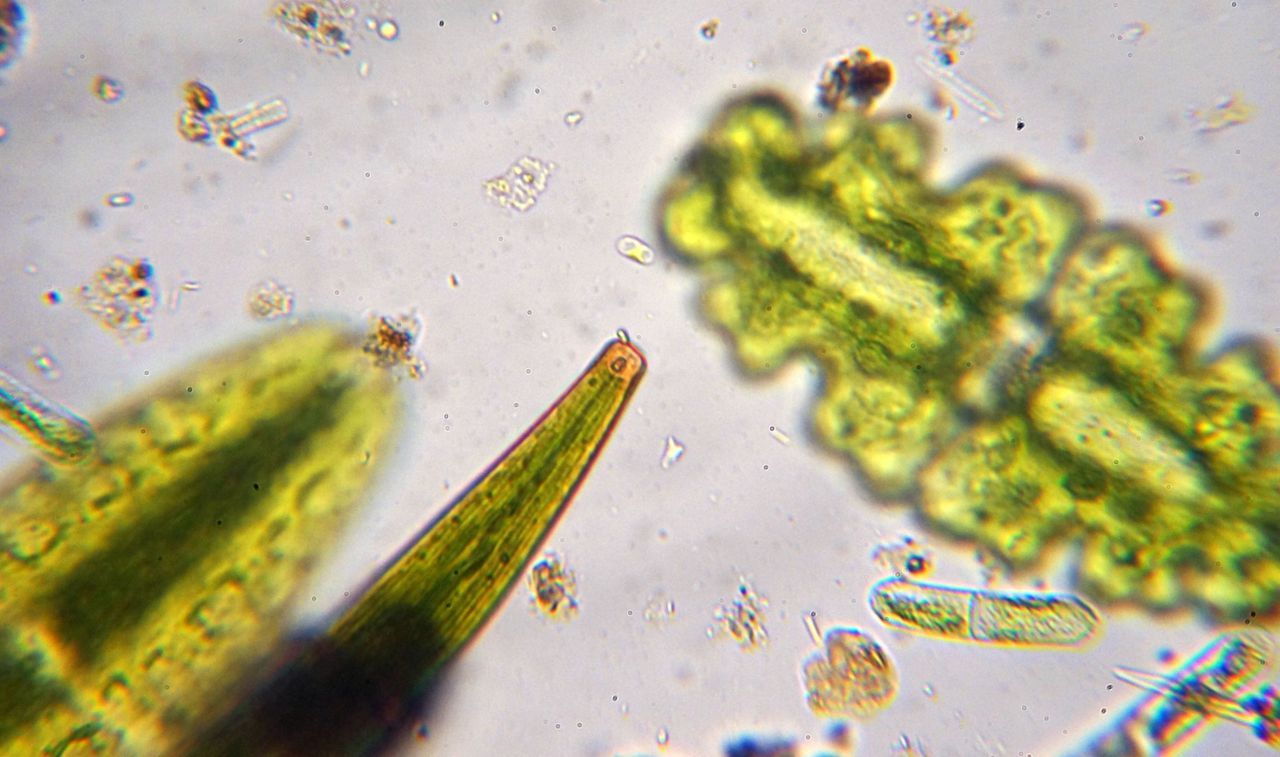 Grote sieralgen van moerassige plaatsen. Op de voorgrond Closterium striolatum, op de achtergrond Netrium digitus (l) en Euastrum oblongum (r). (foto: Jos Gysels)