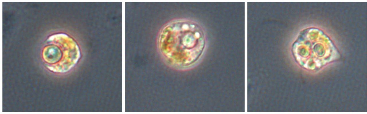 De goudalg Ochromonas eet een giftige blauwalg (Microcystis aeruginosa) op. Links slikt hij hem net in, rechts is de blauwalg inmiddels verorberd. (foto: Susanne Wilken)