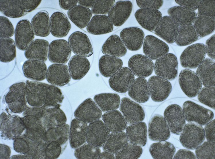 Capsules met individuele eitjes in eisnoer van een Grote vlokslak, Oosterschelde (microscopie opname) (foto: Peter H. van Bragt)