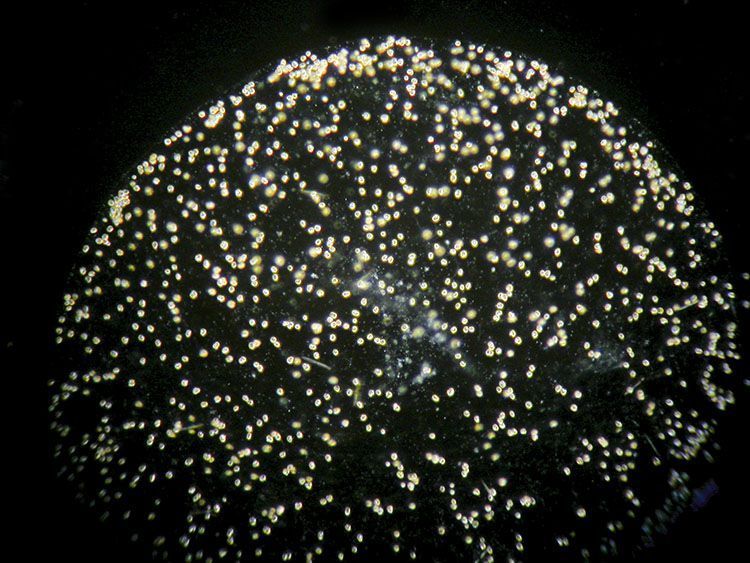 Fasecontrast microscopie-opname van een kolonie schuimalgen. Ieder stipje is een exemplaar van de alg (foto: Peter H van Bragt)