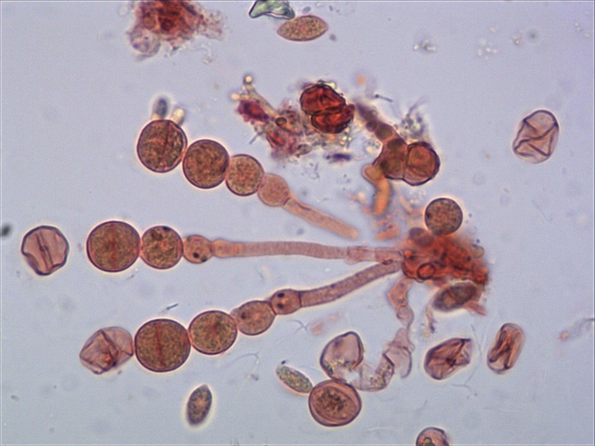 Parelkettingen van sporenvormende cellen (basidiën) (foto: Nico Dam)