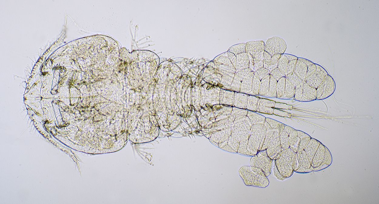 Microscopie-opname van een vrouwtje Grondelnijntje (foto: Marco Faasse)