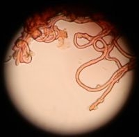 Een microscoop is nodig om de soorten met zekerheid te onderscheiden: hier de gekrulde haren van de Krulhaarkelkzwam (foto: Francine Nouls)