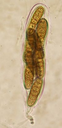 Sexuele sporen Splanchnonema platani (foto: Cees Roobeek)